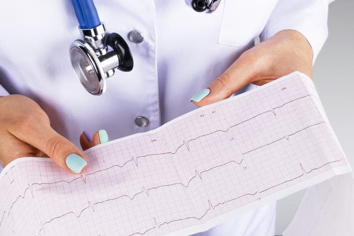ECG