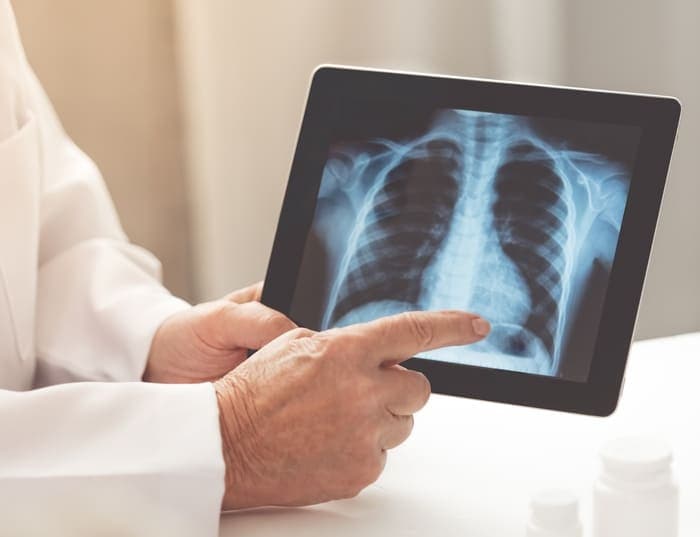 X-Ray
